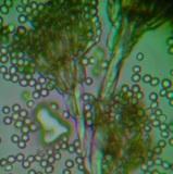 Fungal Specimen Under Microscope